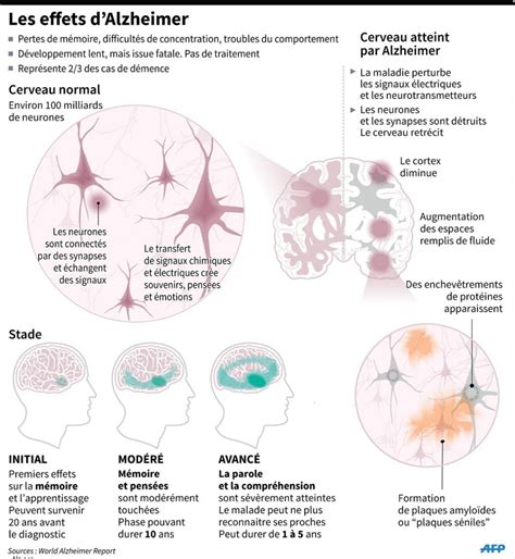 Un danger caché dans l’Alzheimer : les muscles s&rsquo;affaiblissent avant même la mémoire