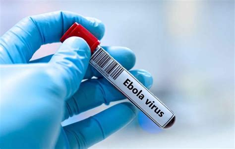 France face à son premier cas d&rsquo;Ebola : une alerte sanitaire sans précédent